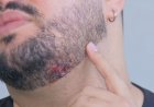 'Senti um arranhão', diz vítima atingida por um dos disparos de PM que matou homem durante rodeio em Marília