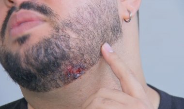 'Senti um arranhão', diz vítima atingida por um dos disparos de PM que matou homem durante rodeio em Marília