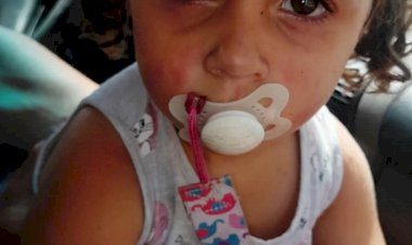 Mãe Denuncia Falta de Atenção em Escola de Marília Durante Crise Alérgica Grave que Poderia Ser Fatal