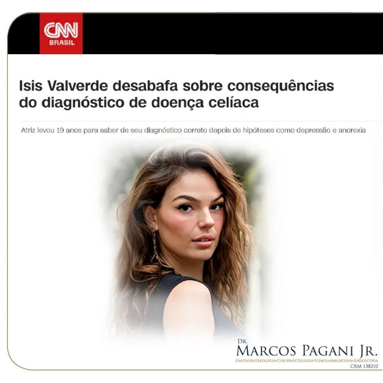 Isis Valverde desabafa sobre consequências do diagnóstico de doença celíaca
