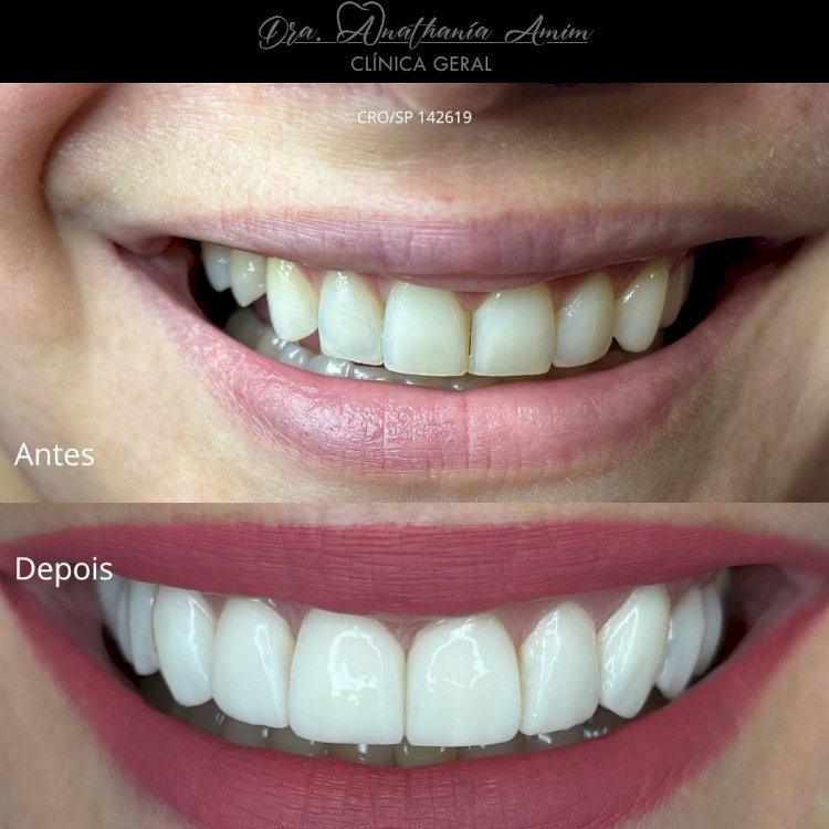 Dentista transforma vidas e Conquista Sucesso através do Mercado Odontológico em Marília