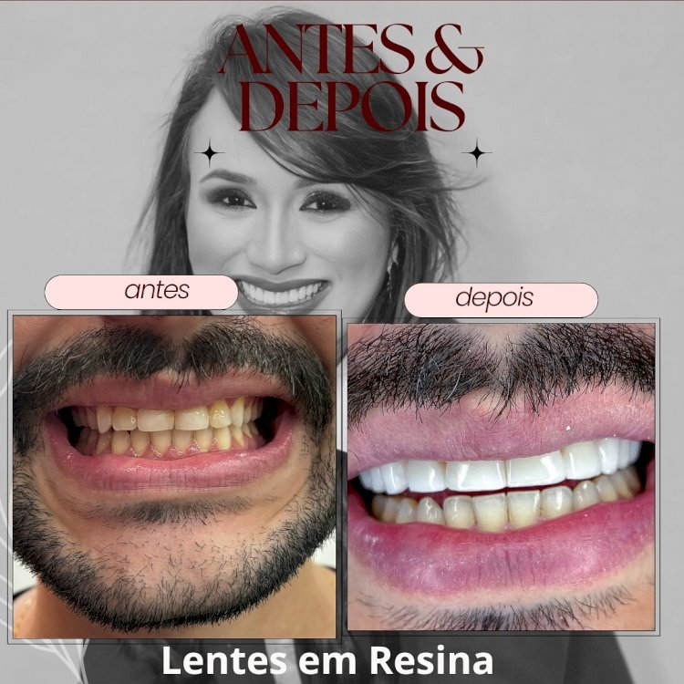 Dentista de Marília Conquista Pacientes Internacionais e Transforma Vidas Através de Sorrisos